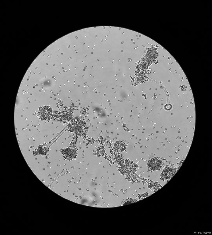 ?如何進(jìn)一步提高微生物菌群的活性和多樣性？