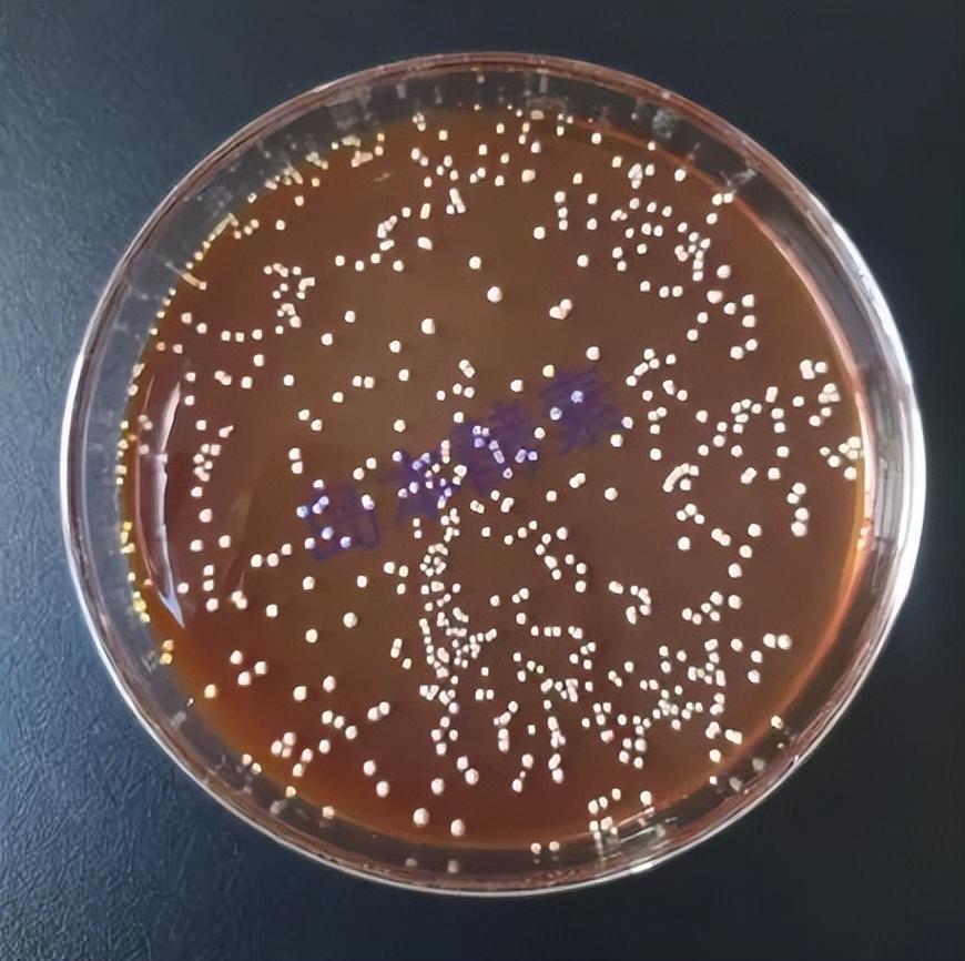 菌肥中常用菌株大揭秘，科學使用助豐收